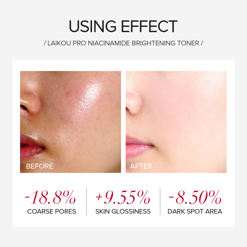 مجموعة العناية بالبشرة المبيضة - مراجعة Niacinamide Brightening Serum وسعره