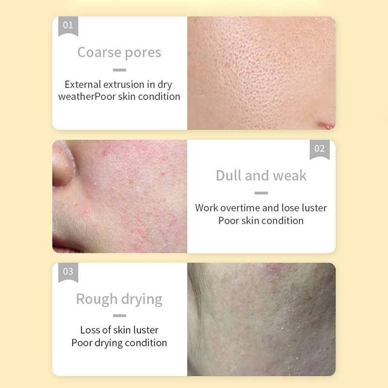30 قطعة SADOER فيتامين C أقنعة - مراجعة Skincare Omg وسعره