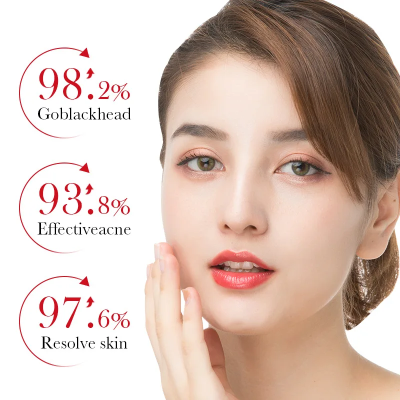 BIOAQUA حمض الساليسيليك حب الش - مراجعة Skincare Garnier وسعره