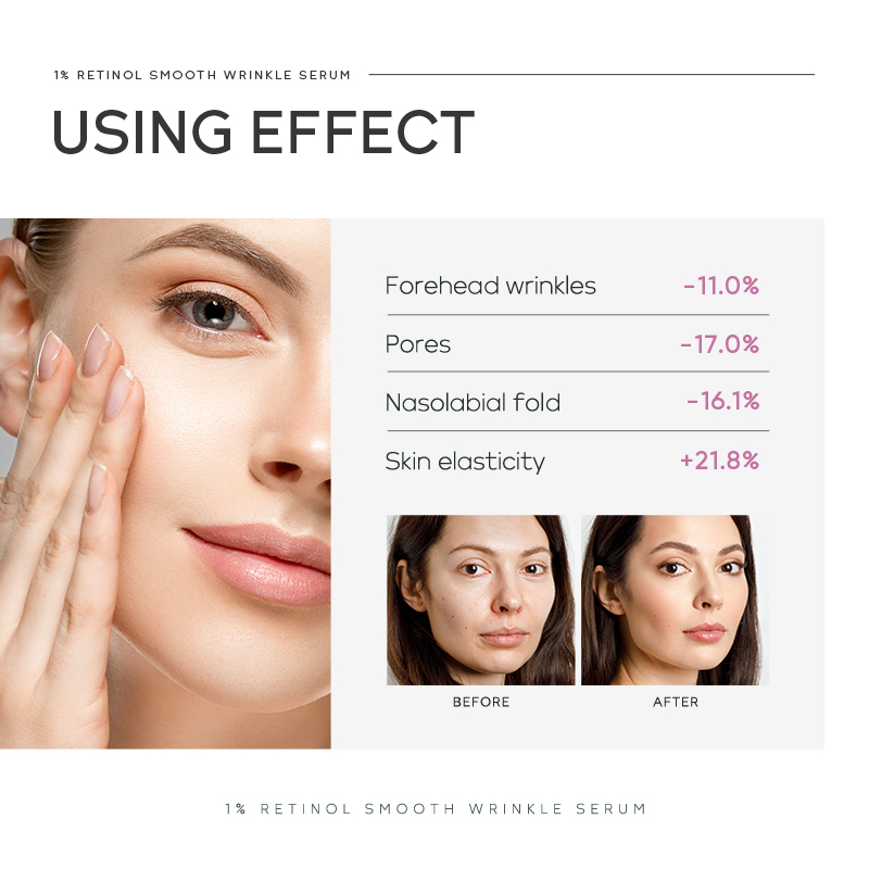 سيروم كويوم 1% ريتينول لتنعيم  - مراجعة Niacinamide Brightening Serum وسعره